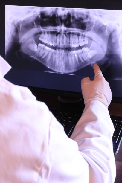 Best Emergency Dentist for Lost Fillings or Crowns in Venetian Vlage, IL