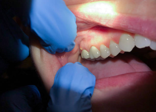 Best Emergency Dental Services for Seniors in Venetian Vlage, IL
