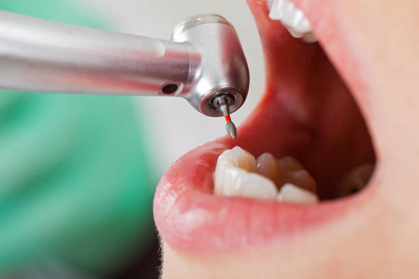 Best Urgent Dental Care for Toothache in Venetian Vlage, IL